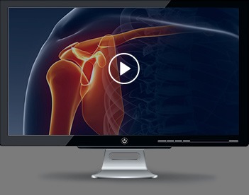 Patient Educational Videos of J. Kristopher Ware, MD - Orthopedic Surgeon - Sports Medicine Specialist 